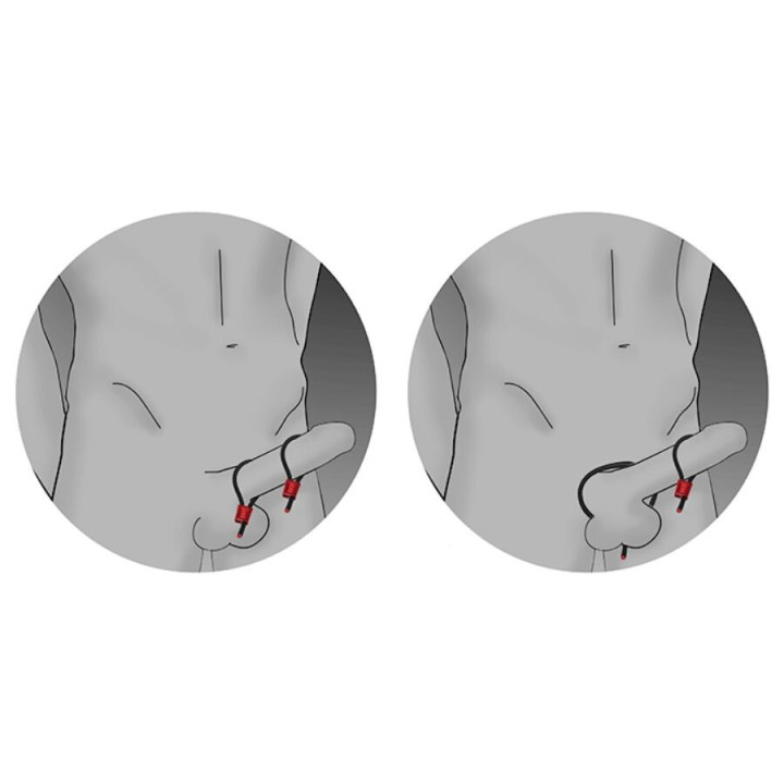 ELECTRASTIM - ANÉIS PENIANOS AJUSTÁVEIS PRESTIGE ELECTRA LOOPS PRETOS