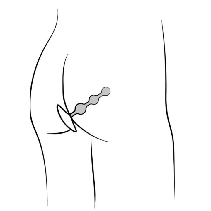 ROMP - AMP CONTAS ANAL DE SILICONE FLEXÍVEIS ROXAS 12.5 CM ROXAS
